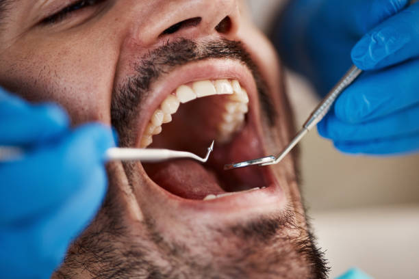 Emergency Dental Services in Seco Mines, TX